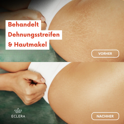 Eclera Magic Oil