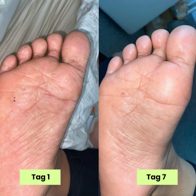 Eclera Antimykotische Pflege-Seife