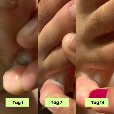 Eclera Antimykotische Pflege-Seife